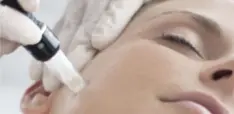 Microneedling mit Pen