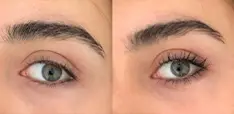 Wimpernlifting